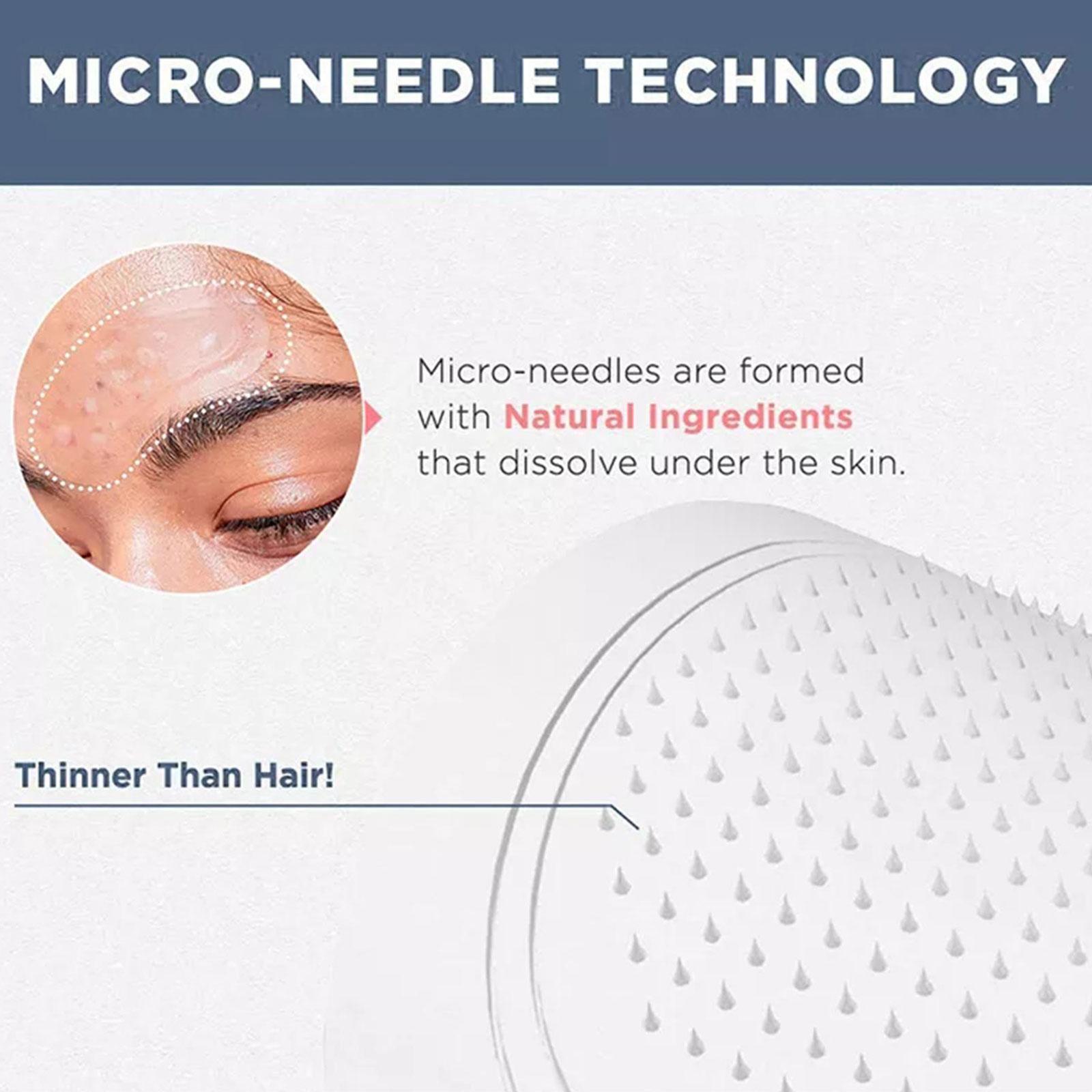 Mikroigłkowa maska pod oczy 0, – Microneedle Patch Eye recenzja i cena
